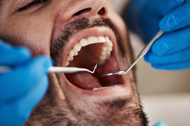 Best Emergency Treatment for Dental Infections or Abscesses in Nags Head, NC